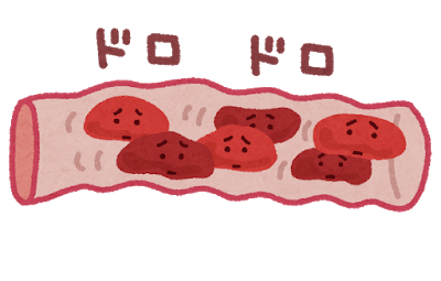 血管イメージイラスト
